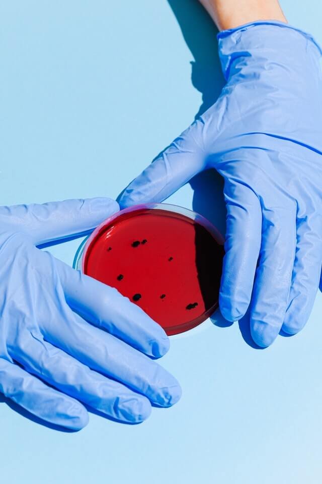 diagnostic-lab-sampling Diagnostic Lab Sampling